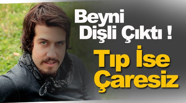 26 yıldır beynindeki dişle yaşıyor